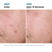 SkinCeuticals Correct Advanced RGN-6 Hidratante 50ml