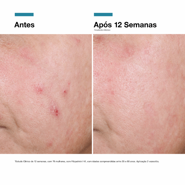 SkinCeuticals Correct Advanced RGN-6 Hidratante 50ml