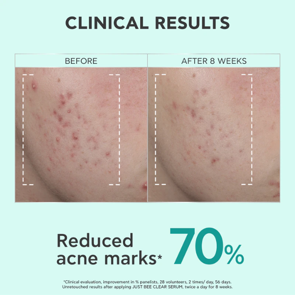 Apivita Just Bee Clear Sérum Redensificador Marcas & Imperfeições 30ml