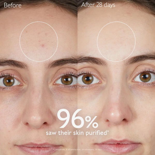 Caudalie Vinopure Cofre Rutina Anti-imperfecciones Piel Acné