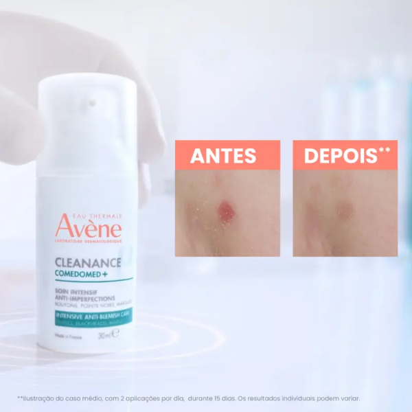 Avène Cleanance Comedomed+ Cuidado Intensivo Anti-Imperfeições 30ml