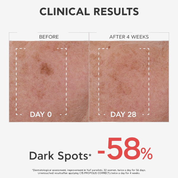 Apivita Bee Tech C15 Sérum Corretor Antirrugas Própolis 30ml