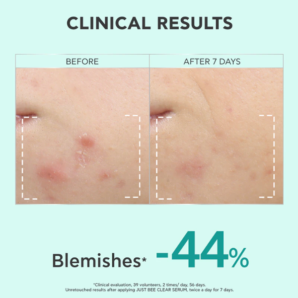 Apivita Just Bee Clear Sérum Redensificador Marcas & Imperfeições 30ml