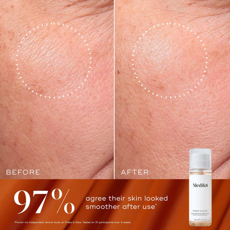 Medik8 Luminous Lift Coffret Brilho Instantâneo & Suavidade