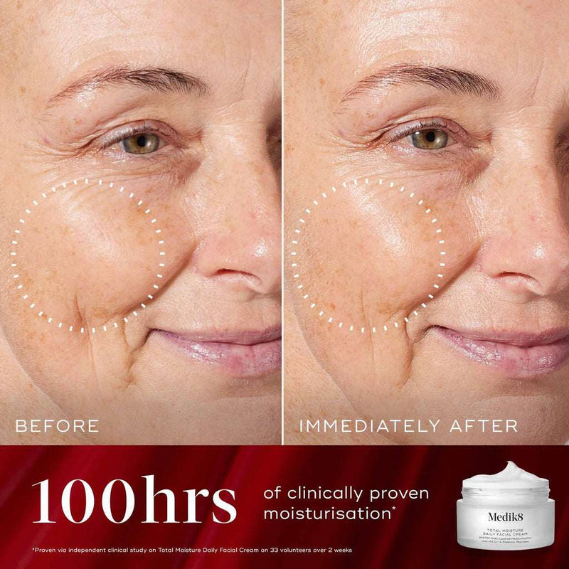 Medik8 Radiance Wrapped Coffret Iluminador Fortalecedor Barreira