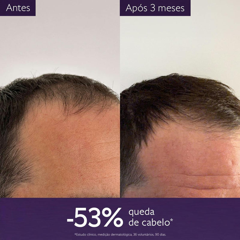 Caudalie Cuidados Capilares Sérum Anti-Queda 50ml