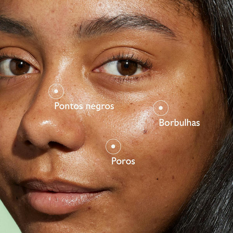 Caudalie Vinopure Sérum Salicílico Anti-imperfeições 30ml