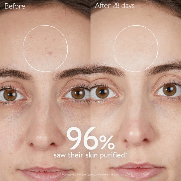 Caudalie Vinopure Coffret Kit Rotina Anti-Imperfeições Pele Acne