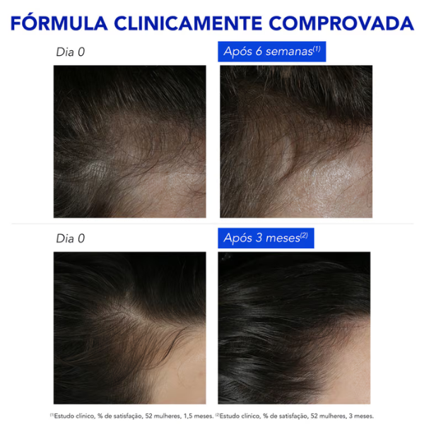 Phyto Phytophanere Pack Queda Reacional Ampolas x12 + OFERTA Champô 100ml
