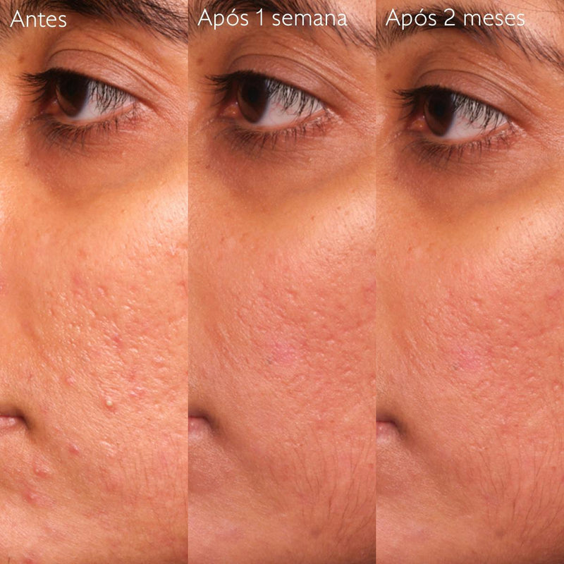 Caudalie Vinopure Sérum Salicílico Anti-imperfeições 30ml