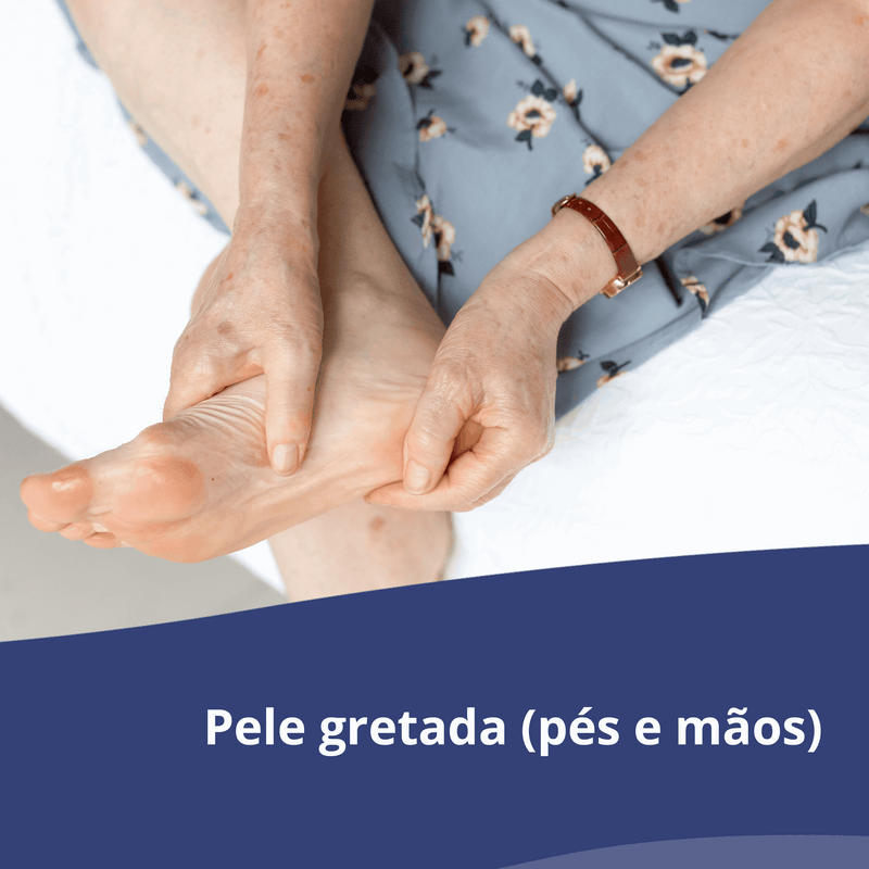 Bepanthene® Pomada Eritemas, Gretas e Lesões