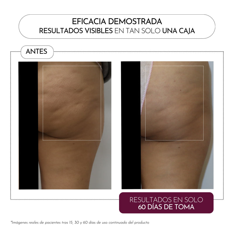 Luxmetique Celulox Fórmula Celulite Gordura Frasco 30ml x15