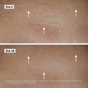 Filorga Hydra-AOX Sérum Antioxidante Intensivo 30ml