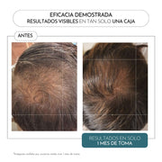 Luxmetique Hair Fórmula Queda Cabelo 60cp.