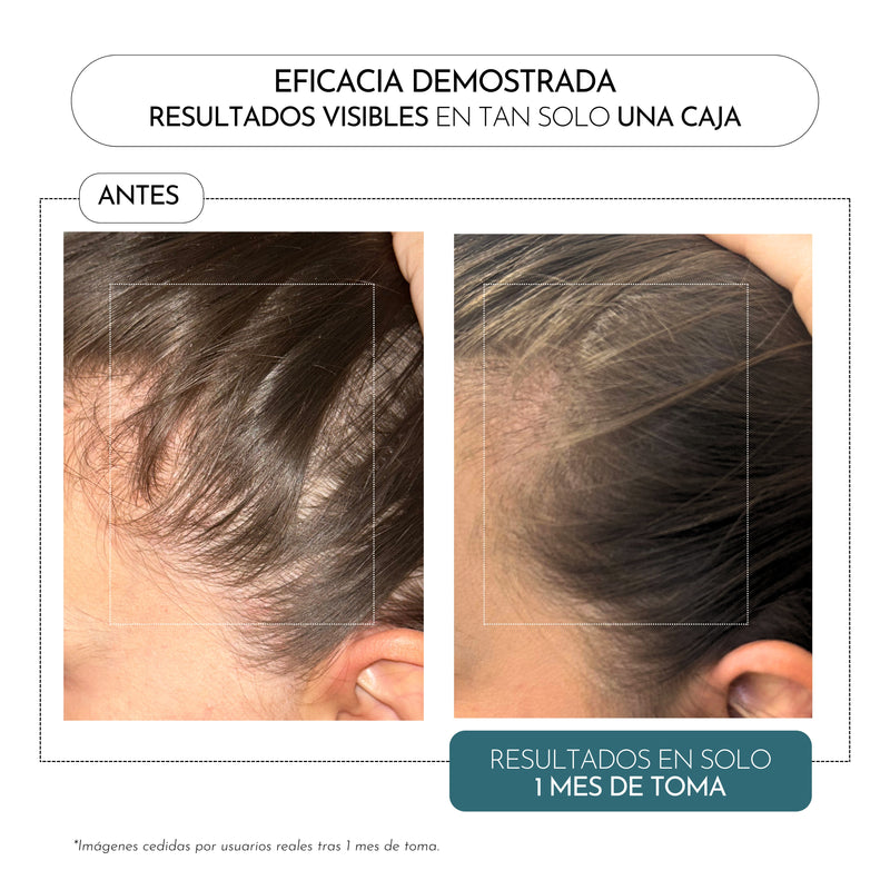 Luxmetique Hair Fórmula Queda Cabelo 60cp.