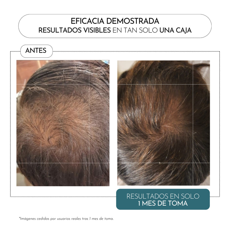 Luxmetique Hair Fórmula Queda Cabelo 60cp.