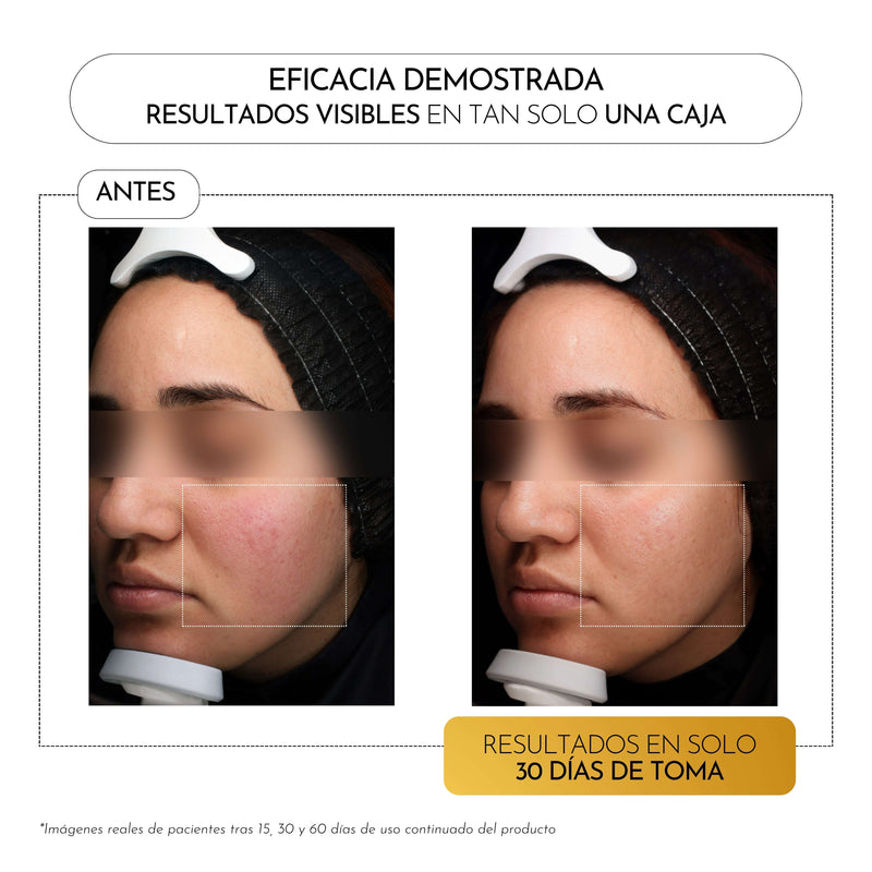 Luxmetique Hyalugold Night Ácido Hialurónico Noite Frasco 30ml x15