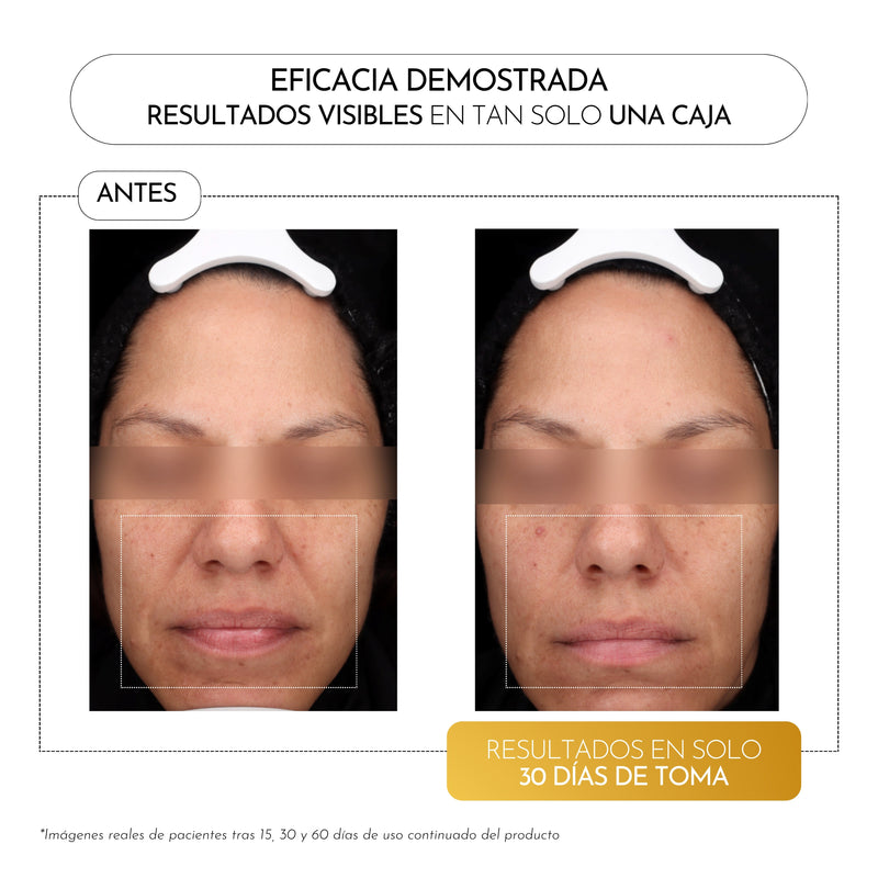 Luxmetique Hyalugold Day Fórmula Ácido Hialurónico Dia Frasco 30ml x15