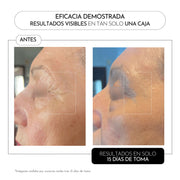 Luxmetique Proage Day Fórmula Anti-Envelhecimento Pele Dia Frasco 30ml x15