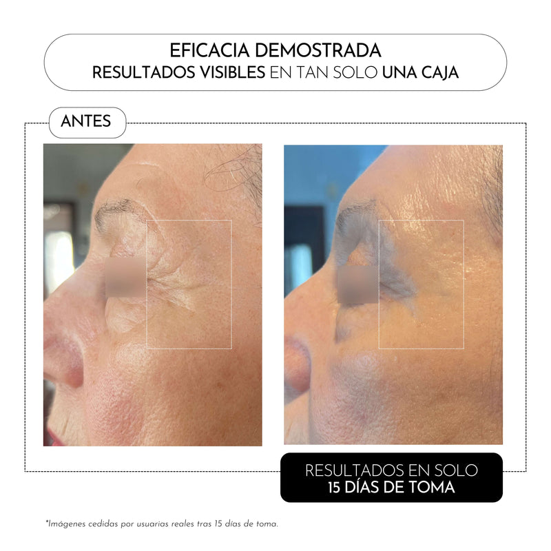 Luxmetique Proage Day Fórmula Anti-Envelhecimento Pele Dia Frasco 30ml x15