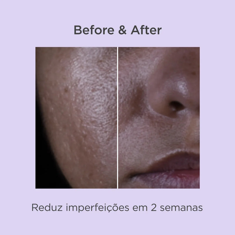 Isdin Isdinceutics Salicylic Renewal Sérum Anti-Imperfeições e Antirrugas 30ml