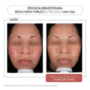 Luxmetique Unifique Fórmula Vermelhidão Imperfeições 60cp.