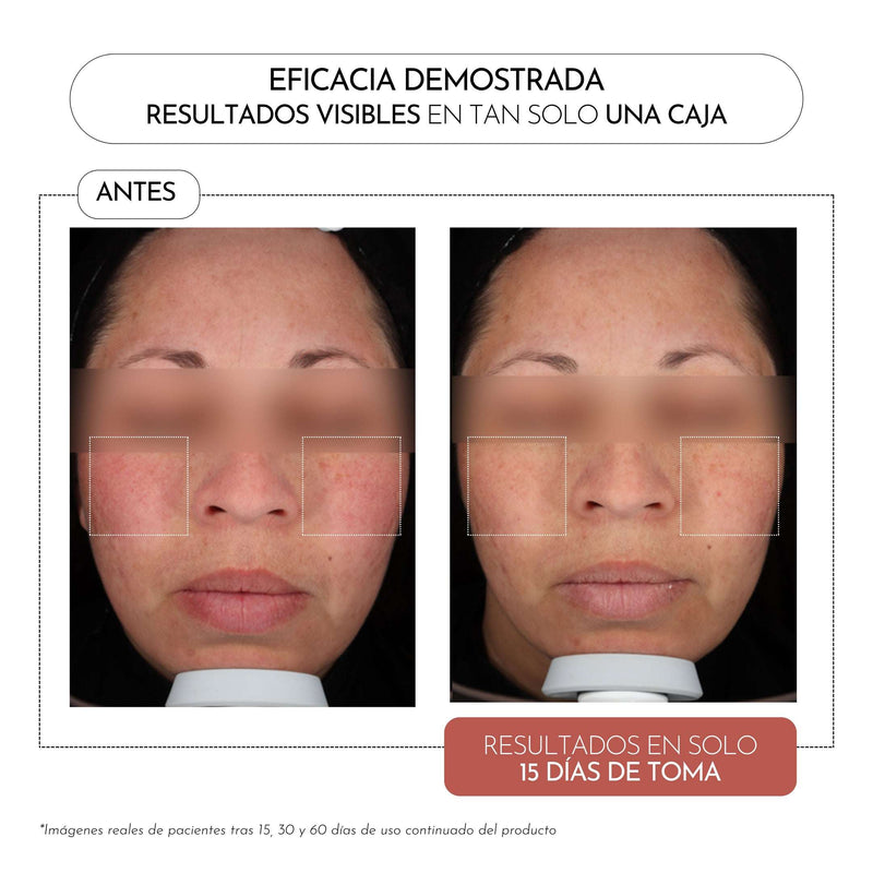 Luxmetique Unifique Fórmula Vermelhidão Imperfeições 60cp.